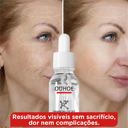 Procedimento Estético em Gotas 15ml: Pele Jovem em Minutos – Sem Agulhas e com Resultados Reais!