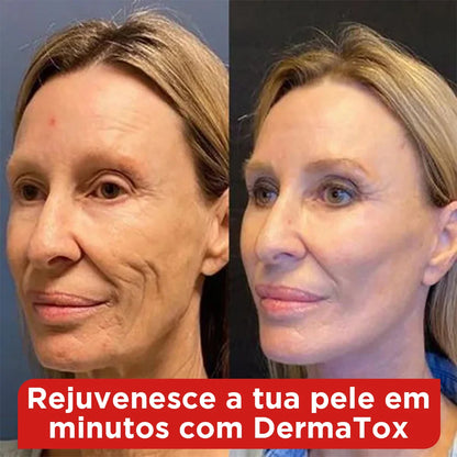 Procedimento Estético em Gotas 15ml: Pele Jovem em Minutos – Sem Agulhas e com Resultados Reais!